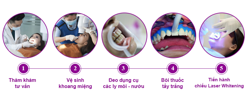 Quy trình tẩy trắng răng Laser Whitening tại Nha khoa Dr Hoàng Tuấn
