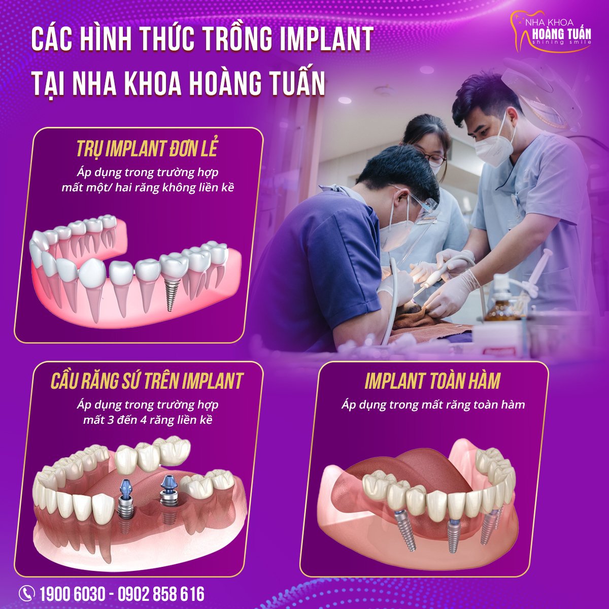 Cấy ghép implant ở đâu tốt nhất