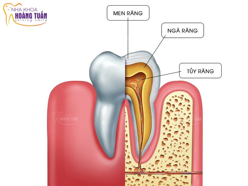 điều trị tuỷ răng