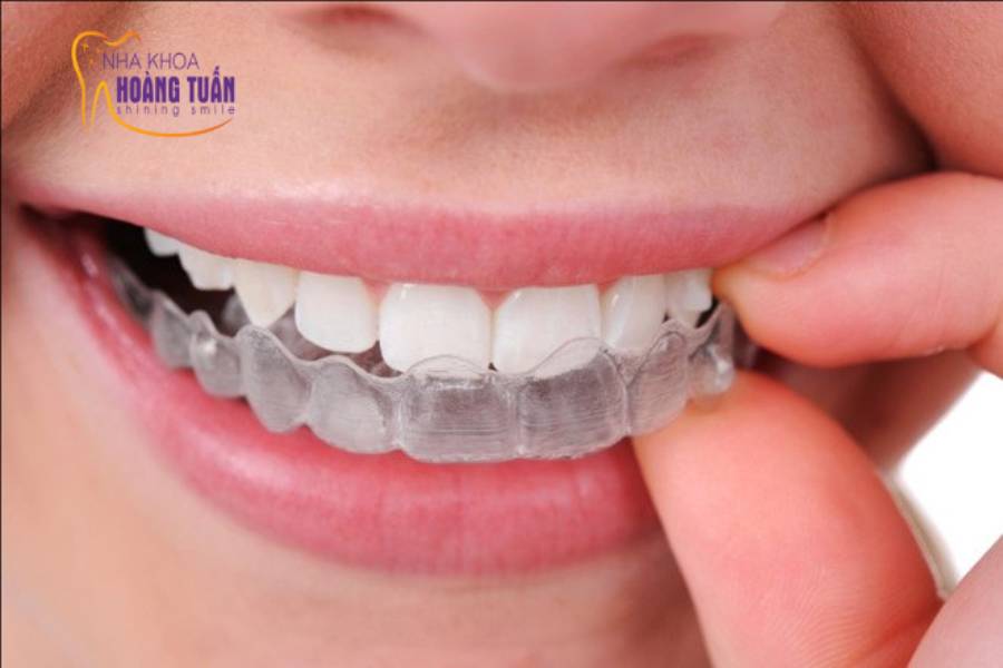 niềng răng invisalign có đau không