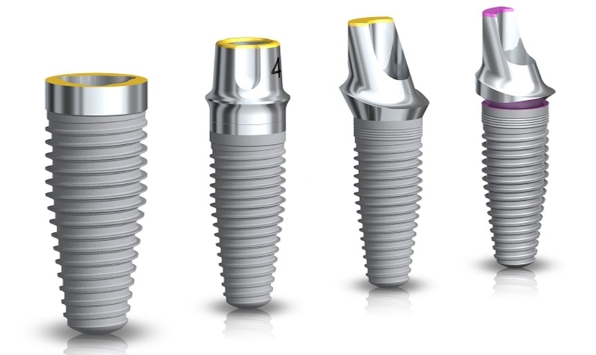 Cấy ghép implant có tốt không