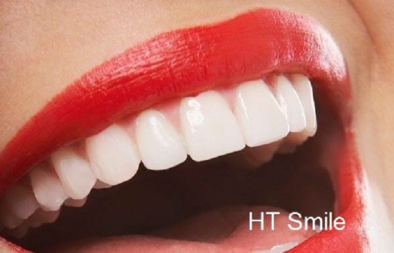 Bọc răng sứ ht smile