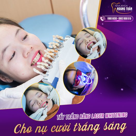 tẩy trắng răng uy tín tại Hà Nội