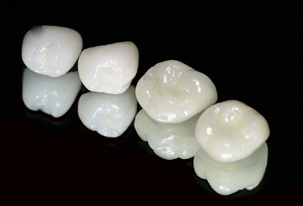 răng sứ zirconia