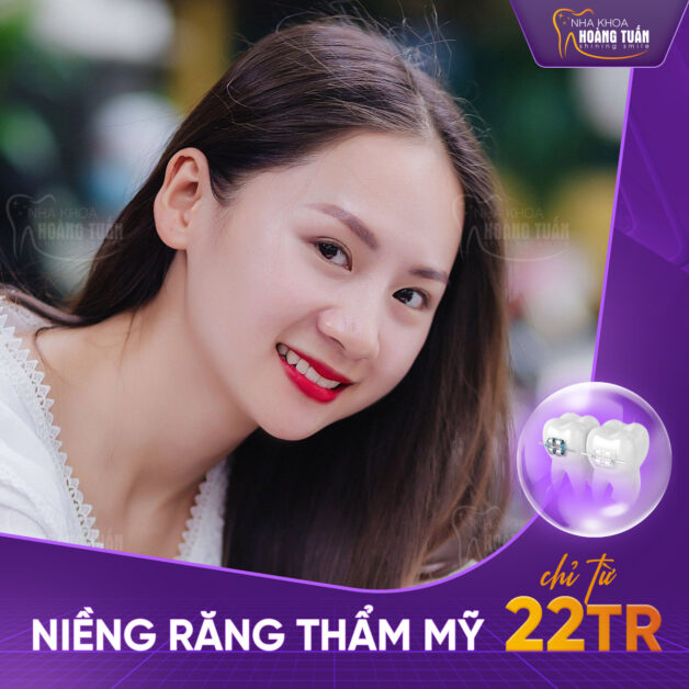 Niềng răng thẩm mỹ