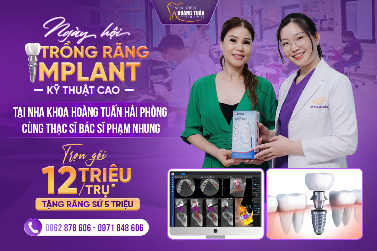 ngay_hoi_trong_rang_implant