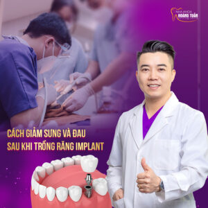 cach_giam_dau_sau_trong_implant