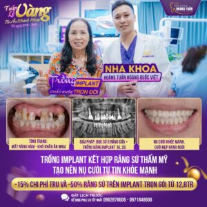 trong_implant_nguoi_cao_tuoi_nha_khoa_hoang_tuan