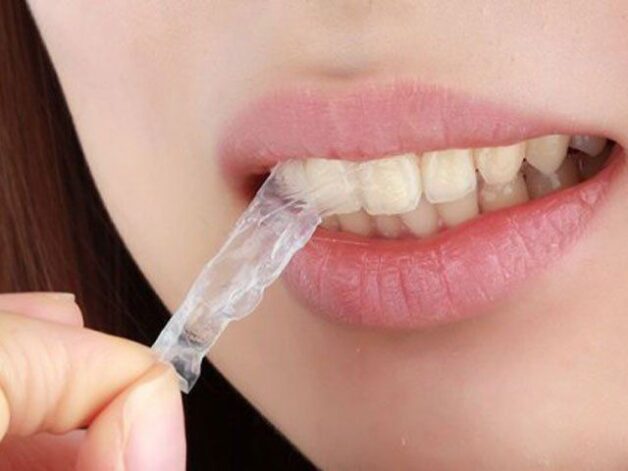 Tẩy trắng răng tại nhà