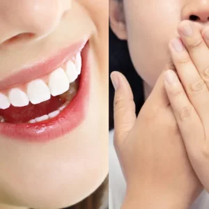 Bọc răng sứ bị hôi miệng
